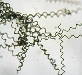 Spirulina spirulina threads